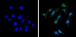 RAD51 Antibody in Immunocytochemistry (ICC/IF)
