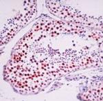 RAD51 Antibody in Immunohistochemistry (Paraffin) (IHC (P))