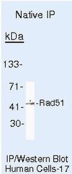 RAD51 Antibody in Immunoprecipitation (IP)