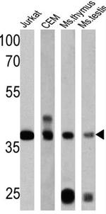 RAD51 Antibody in Western Blot (WB)