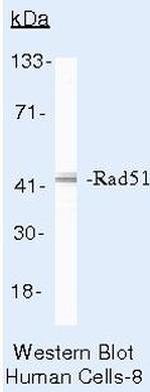 RAD51 Antibody in Western Blot (WB)