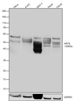 Cytokeratin 8 Antibody in Western Blot (WB)