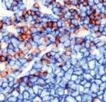 CD3/CD20 Antibody in Immunohistochemistry (Paraffin) (IHC (P))