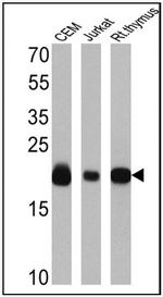 CD3/CD20 Antibody in Western Blot (WB)