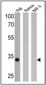 CD3/CD20 Antibody in Western Blot (WB)