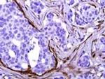 Calponin 1 Antibody in Immunohistochemistry (Paraffin) (IHC (P))
