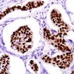 p53 Antibody in Immunohistochemistry (Paraffin) (IHC (P))