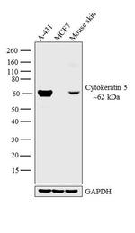Cytokeratin 5 Antibody in Western Blot (WB)