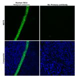 Cytokeratin 5 Antibody in Immunohistochemistry (Paraffin) (IHC (P))