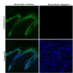 Cytokeratin 5 Antibody in Immunohistochemistry (Paraffin) (IHC (P))