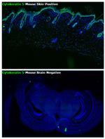 Cytokeratin 5 Antibody