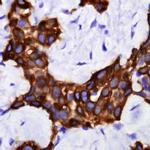 Cytokeratin 5 Antibody in Immunohistochemistry (Paraffin) (IHC (P))