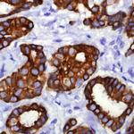 Cytokeratin 18 Antibody in Immunohistochemistry (Paraffin) (IHC (P))