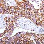 ErbB2 (HER-2) Antibody in Immunohistochemistry (Paraffin) (IHC (P))