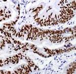 CDX2 Antibody in Immunohistochemistry (Paraffin) (IHC (P))