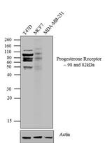 Progesterone Receptor Antibody