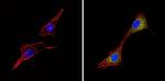 ALK Monoclonal Antibody (SP8)