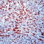 ALK Antibody in Immunohistochemistry (Paraffin) (IHC (P))