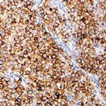 Placental Alkaline Phosphatase Antibody in Immunohistochemistry (IHC)