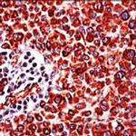 Vimentin Antibody in Immunohistochemistry (IHC)