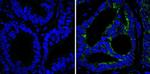 AMACR Antibody in Immunohistochemistry (Paraffin) (IHC (P))