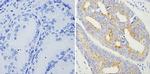 AMACR Antibody in Immunohistochemistry (Paraffin) (IHC (P))