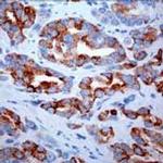 AMACR Antibody in Immunohistochemistry (Paraffin) (IHC (P))