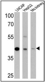 AMACR Antibody in Western Blot (WB)