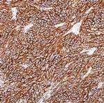 DOG-1 Antibody in Immunohistochemistry (Paraffin) (IHC (P))