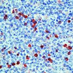 GRP94 Antibody in Immunohistochemistry (Paraffin) (IHC (P))