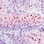 Phospho-c-Raf (Ser338) Antibody in Immunohistochemistry (Paraffin) (IHC (P))