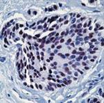 HSF1 Antibody in Immunohistochemistry (IHC)