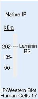 Laminin beta-2/gamma-1 Antibody in Immunoprecipitation (IP)