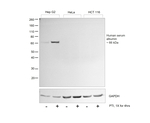 Human Serum Albumin Antibody