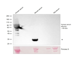Human Serum Albumin Antibody