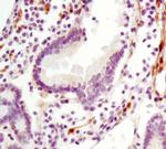 LPP Antibody in Immunohistochemistry (Paraffin) (IHC (P))