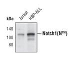 Notch1 Antibody in Western Blot (WB)