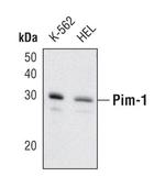 PIM1 Monoclonal Antibody (G.360.1)