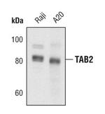 TAB2 Monoclonal Antibody (G.188.0)