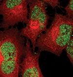 Phospho-STAT5 alpha (Tyr694) Monoclonal Antibody (J.536.2)