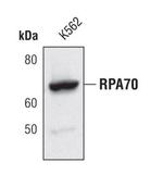 RPA70 Antibody in Western Blot (WB)