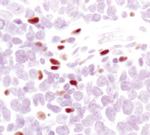 ALOX5 Monoclonal Antibody (G.590.2)