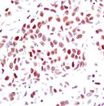 Progesterone Receptor Antibody in Immunohistochemistry (Paraffin) (IHC (P))