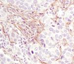 PDGFRB Monoclonal Antibody (R.140.4)