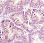 AXIN1 Monoclonal Antibody (K.53.7)