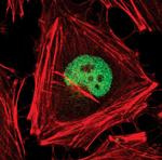 AP2 alpha Monoclonal Antibody (R.387.0)