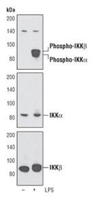 Phospho-IKK alpha/beta (Ser176, Ser177) Monoclonal Antibody (J.10.3)