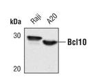 Bcl-10 Monoclonal Antibody (E.177.7)