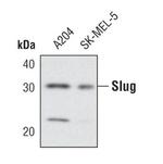 Slug Antibody in Western Blot (WB)