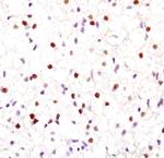 PPAR gamma Antibody in Immunohistochemistry (Paraffin) (IHC (P))